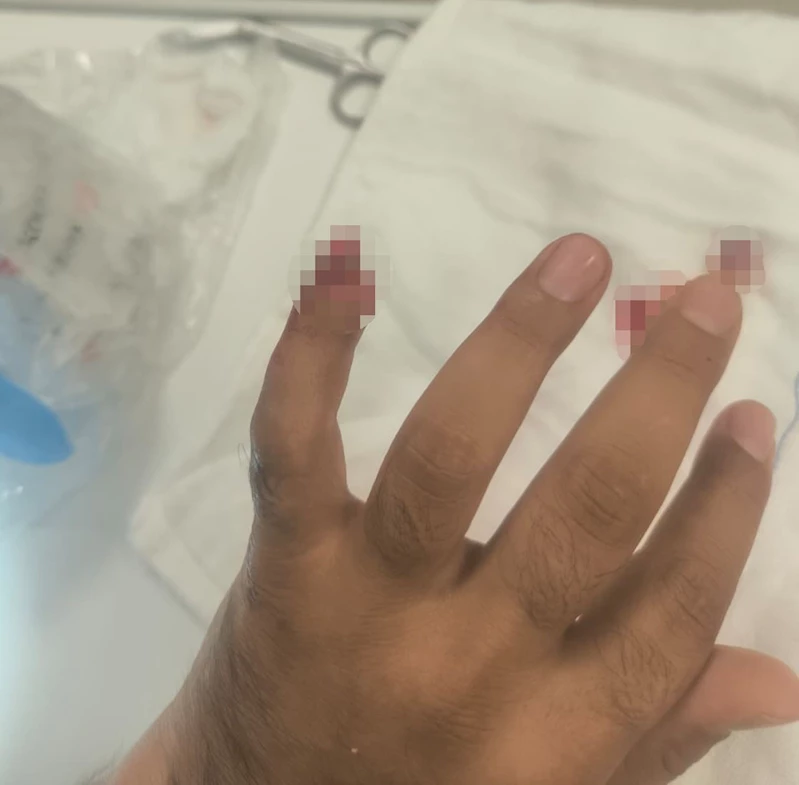 UYUŞTURUCUYLA YAKALANAN ŞÜPHELİ, POLİSİN PARMAĞINI KOPARDI